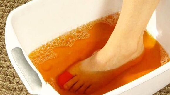 Iodine bath against foot fungus. 
