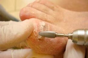 Mechanical nail plate