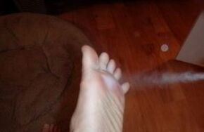 spray treatment of the foot affected by the fungus